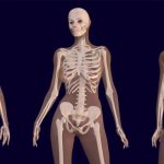 La osteoporosis en mujeres