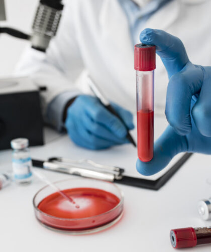 Importancia de los exámenes de laboratorio en tu chequeo anual
