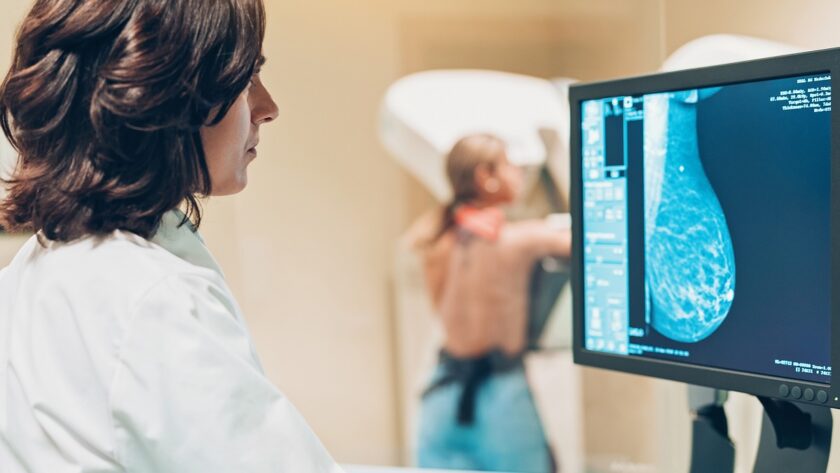 Precio de mamografía: Impacto de la tecnología en los costos