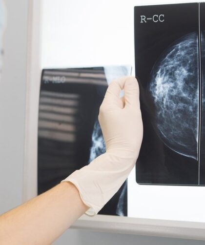Estudios para cáncer de mama: Guía completa para pacientes