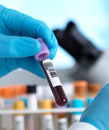Prueba de sangre precio en México: Factores por considerar