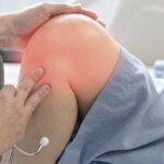 rodilla con condromalacia