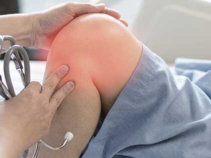 rodilla con condromalacia