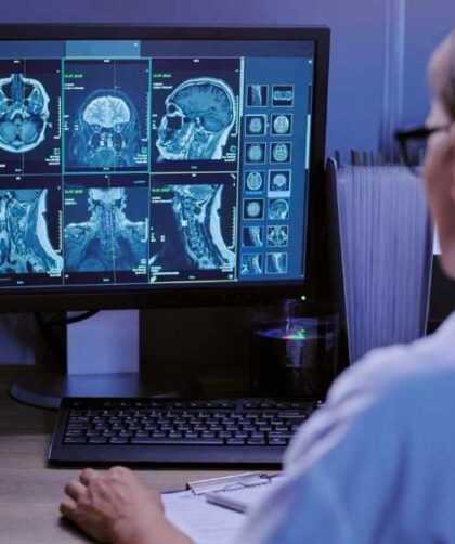Médico revisando imágenes cerebrales durante un proceso de seguimiento neurológico.